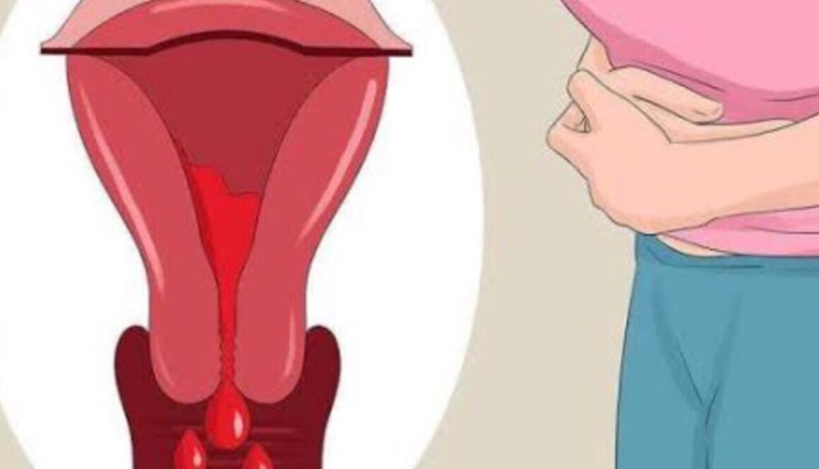 Anormal Rahim (Uterin) Kanaması Nedir?