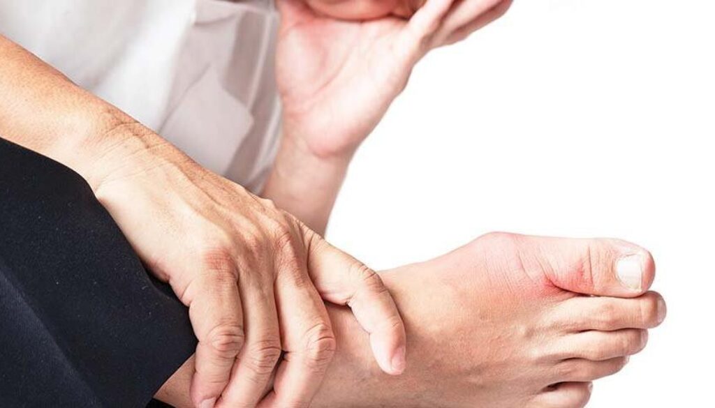 Gut Hastalığı Nedir?