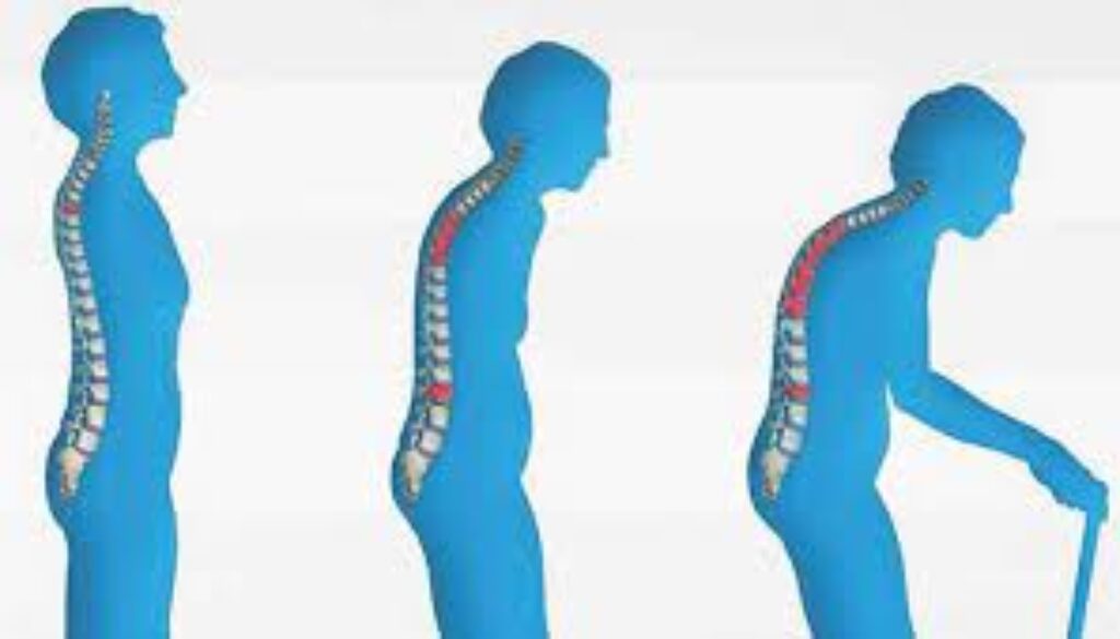 Osteoporoz