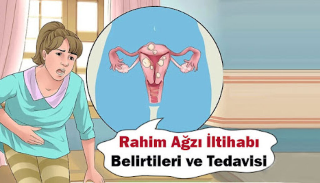 RAHİM İLTİHABI NEDİR?