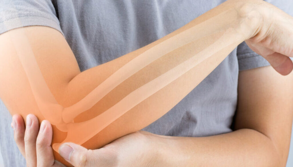 Romatizma nedir?