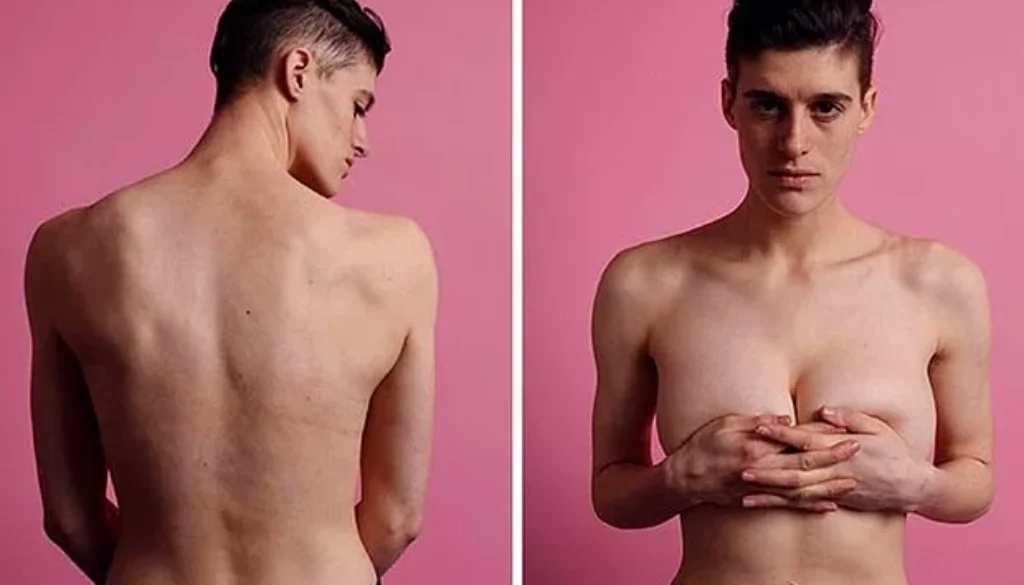 HERMAFRODİTİZM (ÇİFT CİNSİYETLİLİK) NEDİR?
