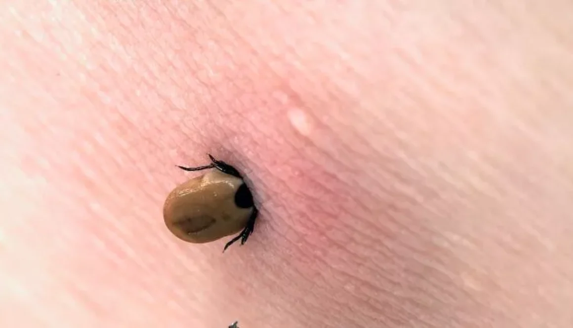 Lyme