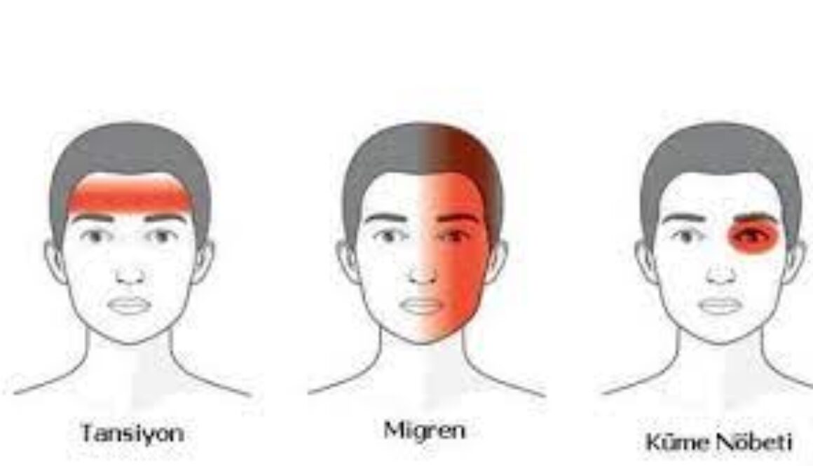 Migren