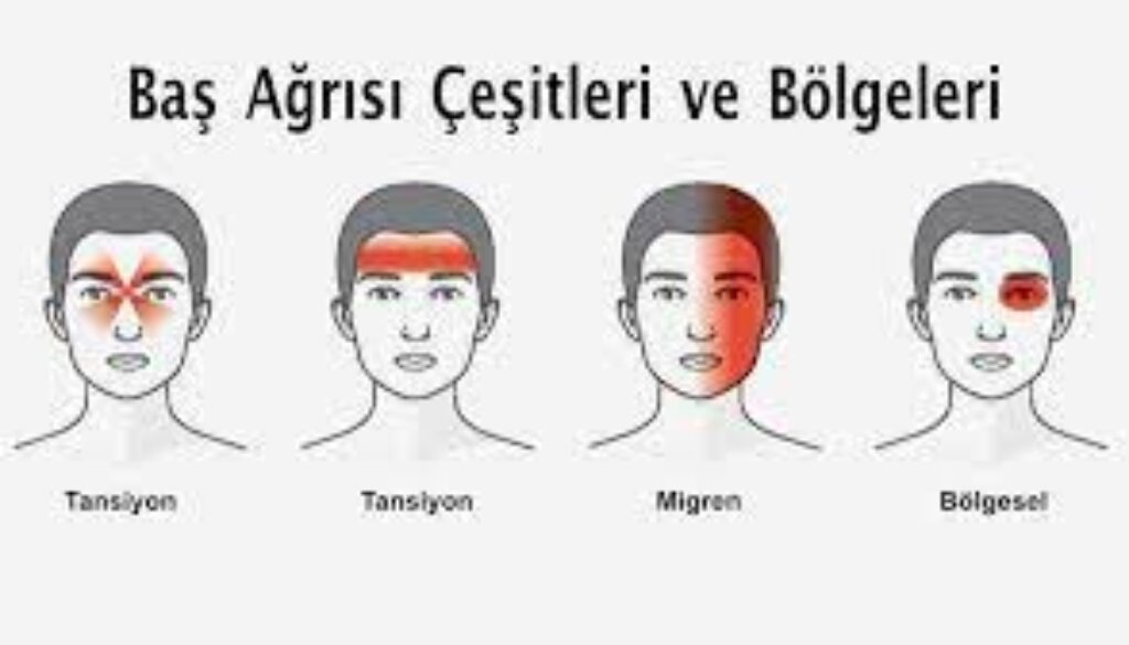 Baş ağrısı