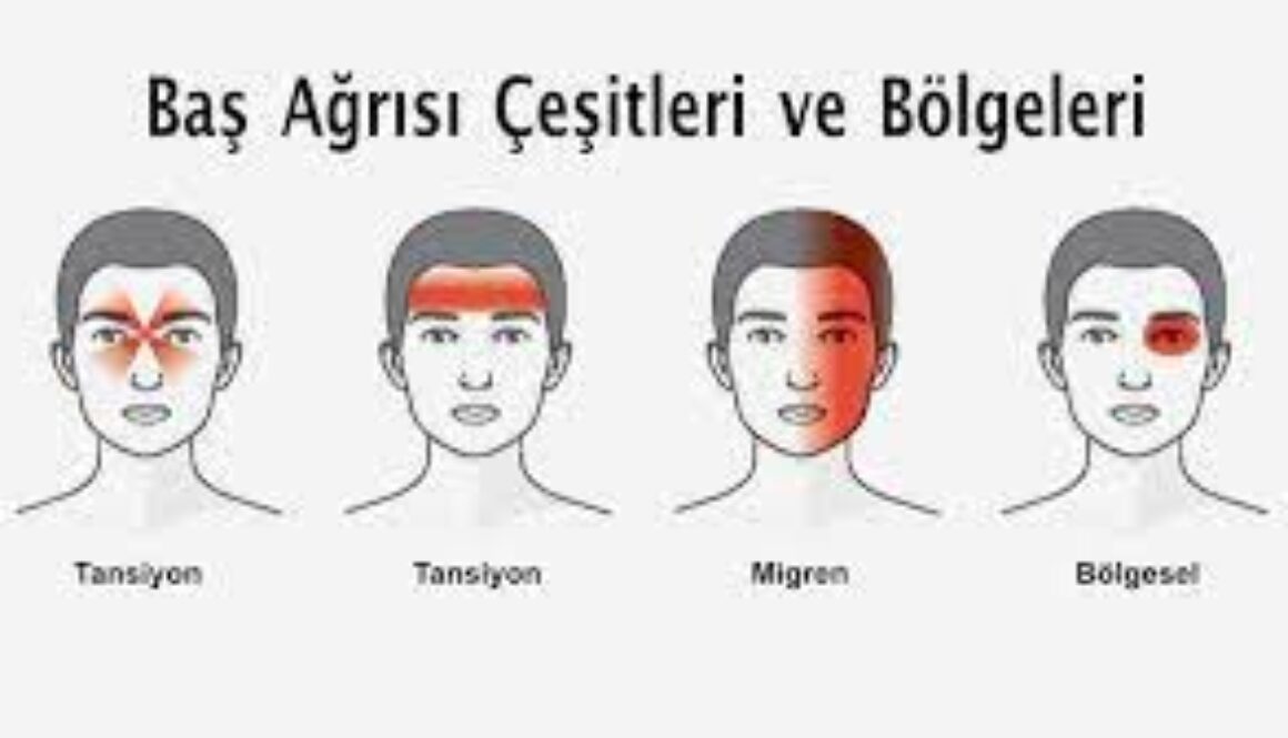 Baş ağrısı