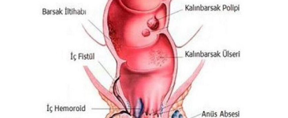 anüs-kaşıntısı